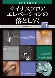 [A12306620]CTで検証する　サイナスフロアエレベーションの落とし穴 野阪 泰弘