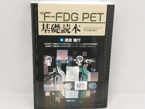 18F-FDG PET基礎読本 渡邉直行