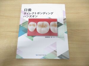 ●01)【同梱不可】臼歯ダイレクトボンディング ハンズオン/佐藤貴彦/デンタルダイヤモンド社/2023年発行/A