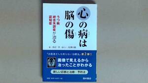 R53W6B●心の病は脳の傷―うつ病・統合失調症・認知症が治る