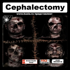 CEPHALECTOMY 大全集 MP3CD 1P◇