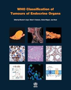 [A12259292]Who Classification of Tumours of Endocrine Organs (World Health