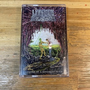 【期間限定50%OFF!!】 UNDEATH / LESIONS OF A DIFFERENT KIND (ミュージックテープ)