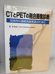 CTとPETの融合画像診断: 効率的な腫瘍病巣発見のために 金芳堂