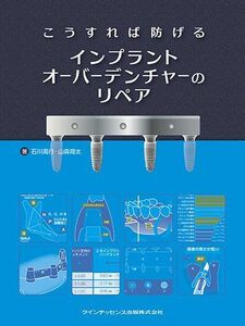 [A11376795]こうすれば防げるインプラントオーバーデンチャーのリペア [単行本（ソフトカバー）] 石川 高行; 山森 翔太