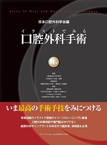 【中古】 イラストでみる口腔外科手術 第1巻