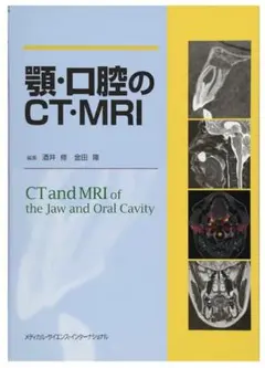 顎・口腔のCT・MRI