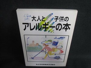 大人と子供のアレルギーの本　シミ日焼け強/RFE