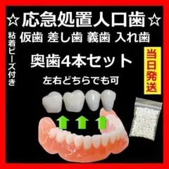 仮歯　差し歯　入れ歯　奥歯　4本　フィッティングビーズ付き