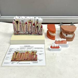 【歯科・歯科診療】歯科用模型　STUDY MODEL/スタディモデル　断面モデル　セット　まとめ売り【中古・現状品】