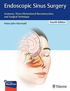 [A12253829]Endoscopic Sinus Surgery: Anatomy， Three-Dimensional Reconstruct