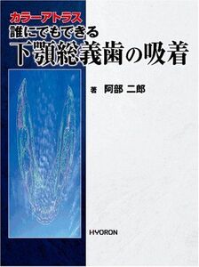 [A01325584]誰にでもできる下顎総義歯の吸着 阿部二郎