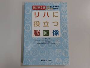 リハに役立つ脳画像 改訂第2版 酒向正春