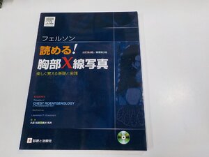 K5458◆フェルソン読める!胸部X線写真 楽しく覚える基礎と実践 ローレンス・R・グッドマン エルゼビア・ジャパン ☆