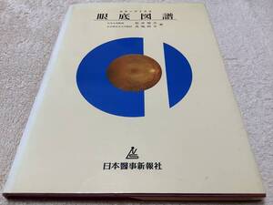 カラーアトラス 眼底図譜 / 松井瑞夫 / 日本醫事新報社