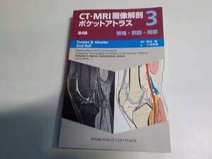 4P0237◆CT・MRI画像解剖ポケットアトラス (3) 脊椎/四肢/関節 トルステン B. メーラー エミール レイフ 町田徹 (ク）