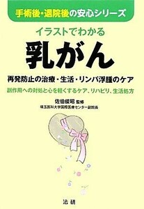 イラストでわかる乳がん 再発防止の治療・生活・リンパ浮腫のケア 手術後・退院後の安心シリーズ／佐伯俊昭【監修】