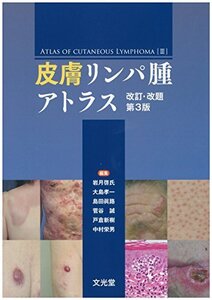 【中古】 皮膚リンパ腫アトラス