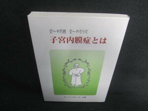 女の月経・女のからだ子宮内膜症とは　シミ日焼け有/DBE