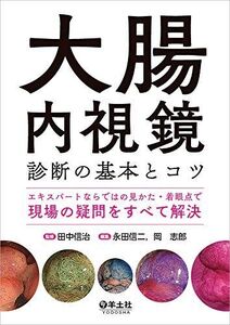 [A11973685]大腸内視鏡診断の基本とコツ?エキスパートならではの見かた・着眼点で現場の疑問をすべて解決