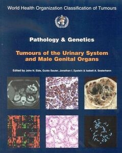 [A11008152]Pathology And Genetics of Tumours of the Urinary System and Male