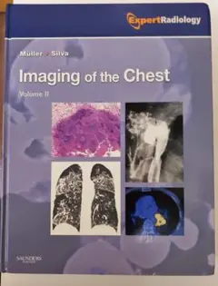 Imaging of the Chest, 2-Volume Set