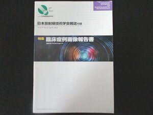 本 No1 01051 日本放射線技術学会雑誌付録 2021年4月号 特集 臨床症例画像報告書 造影CTにおる左心耳閉鎖術（LAAC）の術前評価 TFCC損傷