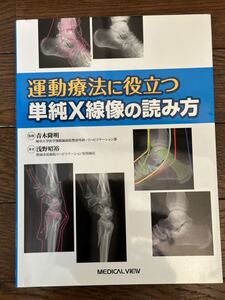 運動療法に役立つ　単純X線像の読み方