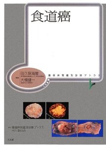 【中古】 食道癌 腫瘍病理鑑別診断アトラス