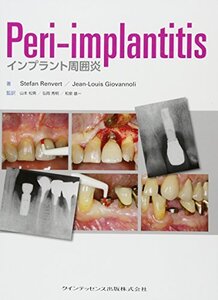 【中古】 Peri-implantitis