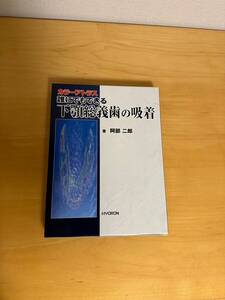 カラーアトラス 誰にでもできる 下顎総義歯の吸着　歯科　矯正歯科