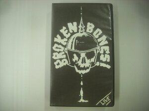 ■ VHS 　BROKEN BONES ブロークン・ボーンズ / LIVE AT LEEDS ライヴ・アット・リーズ 21ST APRIL 84 輸入 JETTISOUNDZ J.J. 129 ◇r60813