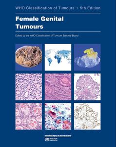 [A12324686]Female Genital Tumours: Who Classification of Tumours (Who Class