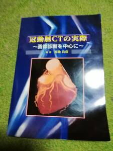 【送料無料】冠動脈CTの実際～画像診断を中心に～/暑地良彦