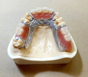 送料込み　上顎金属床　歯科 サンプル 見本 入れ歯 歯科技工　自費　資料