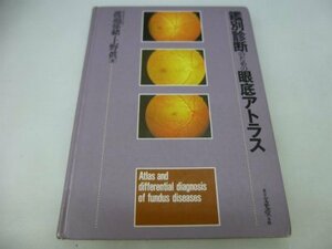 【中古】 鑑別診断のための眼底アトラス