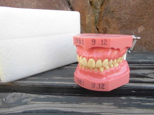 歯科 総義歯 サンプル 模型