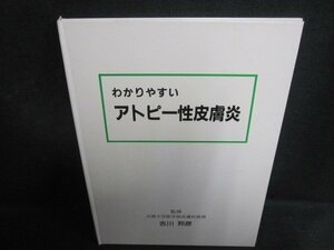 わかりやすいアトピー性皮膚炎　シミ日焼け有/QDZC