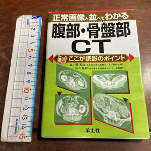 正常画像と並べてわかる腹部・骨盤部ＣＴ （ここが読影のポイント） 扇和之／編　山下晶祥／編　羊土社