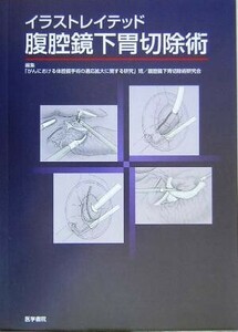 イラストレイテッド 腹腔鏡下胃切除術/「がんにおける体腔鏡手術の適応拡大に関する研究」班腹腔鏡下胃切除研究会(編者)