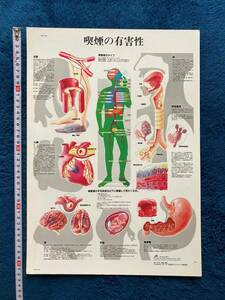 ミニポスター　☆　インテリア雑貨　レア貴重　喫煙の有害性　人体模写　１枚　プラシート　禁煙グッズ　壁飾り　啓発ポスター