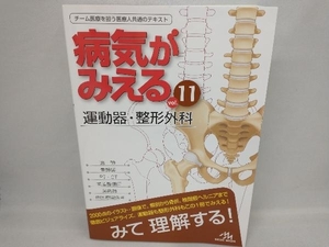 病気がみえる 運動器・整形外科 第1版(vol.11) 医療情報科学研究所