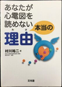 あなたが心電図を読めない本当の理由