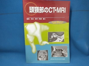 頭頸部のCT・MRI 多田信平